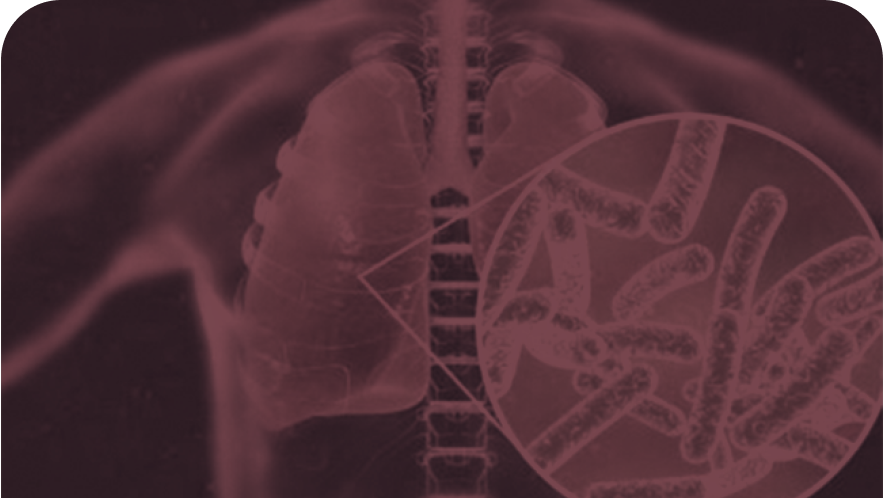 Legionnaires' disease and dental unit water